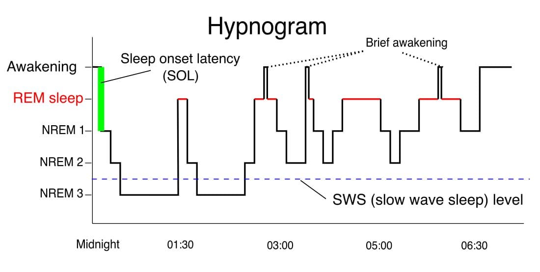 Sleep hypnogram showing the progression through NREM stages, including deep slow-wave sleep (N3), and REM across a night.