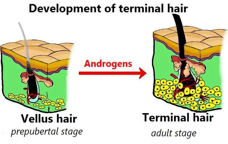 Labeled diagram contrasting fine vellus hair with thick pigmented terminal hair on skin