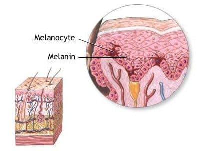 Labeled cross-section illustration of skin layers showing melanocytes in the epidermis